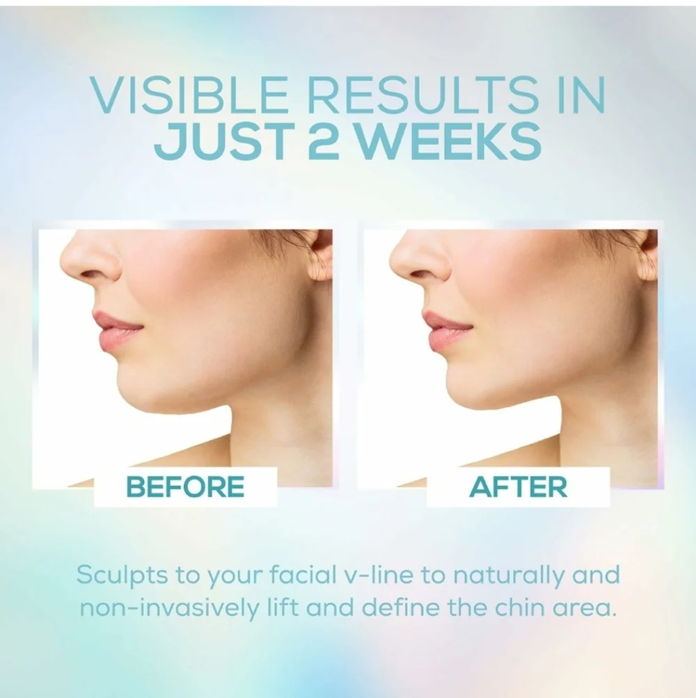 V-Line Chin Strap, Reusable